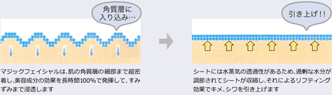 しわを引き上げる仕組み